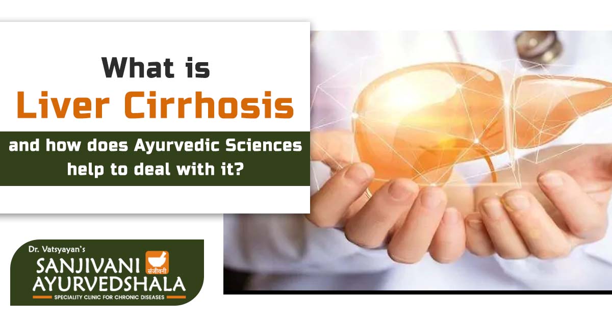 What is Liver Cirrhosis and how does Ayurvedic Sciences help to deal with it?