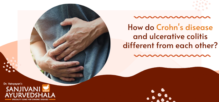 How do Crohn’s disease and ulcerative colitis different from each other?