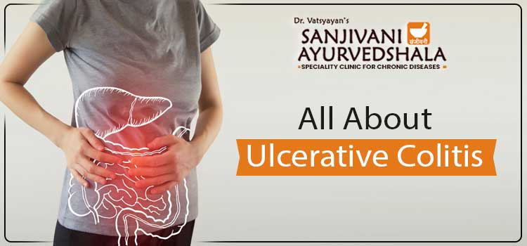 All About - Ulcerative Colitis