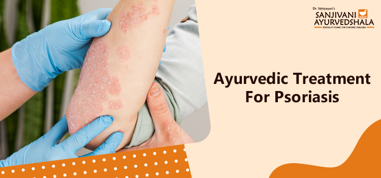 How effective is Ayurvedic treatment for Psoriasis? How does it work?