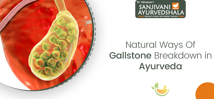 4 common and natural means in Ayurveda to dissolve Gallstone