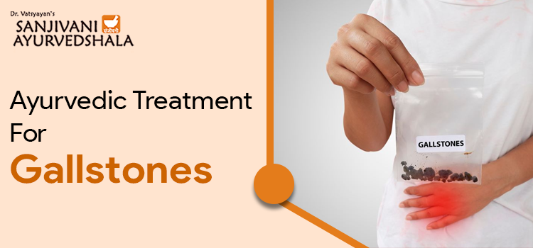 What Are Gallstones, Their Causes, Symptoms And Ayurvedic Treatment?